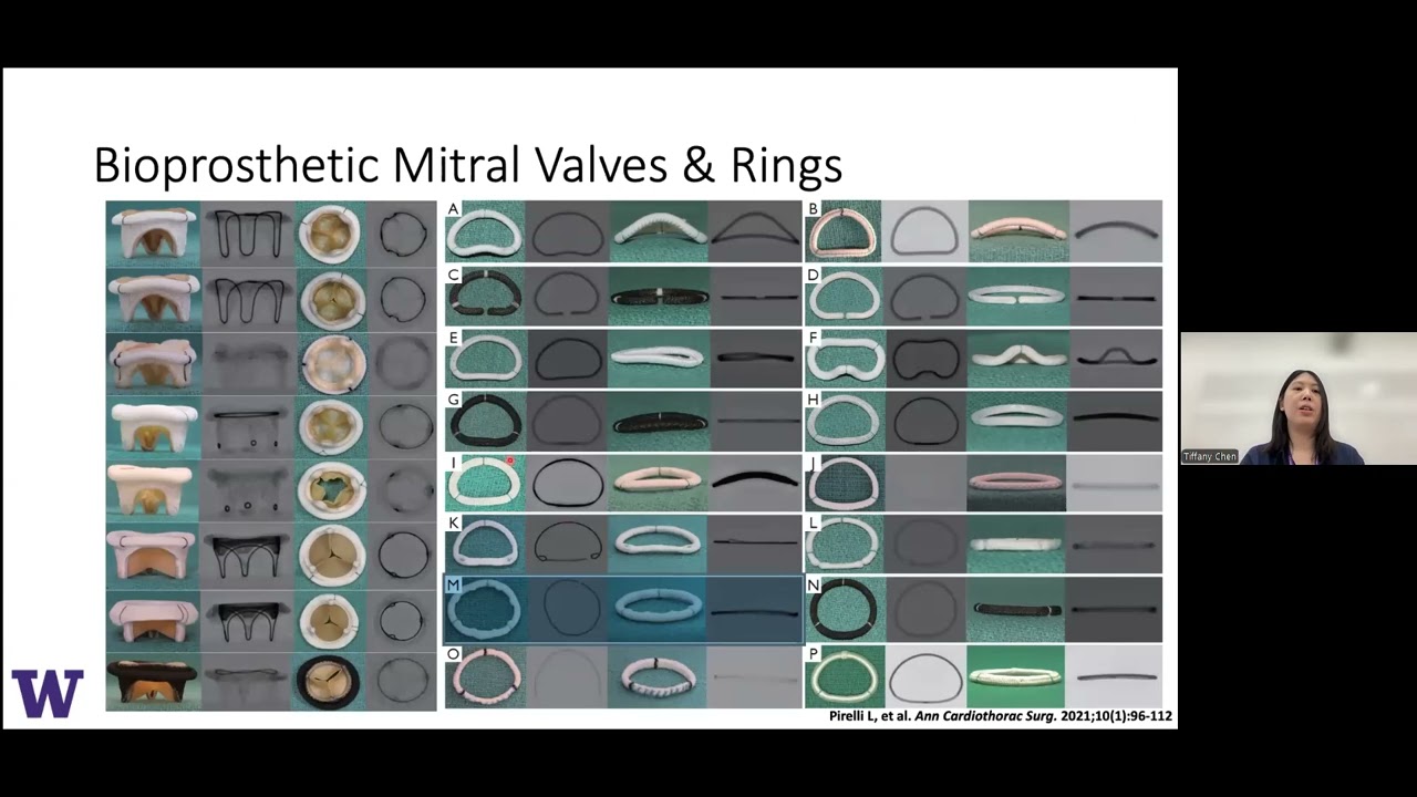 Multimodality Imaging of Prosthetic Valves: Why, When, and How: Cardiology Grand Rounds 11/22/24