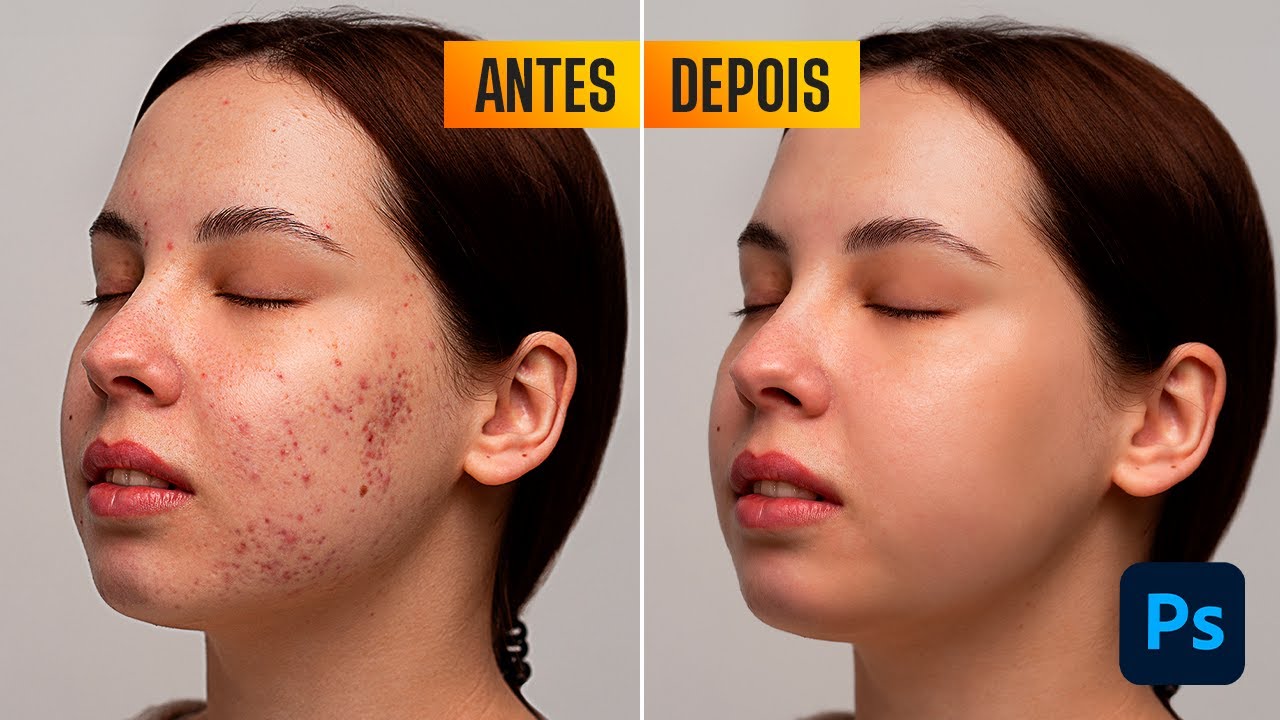 Como REMOVER ESPINHAS no Photoshop - 3 MELHORES TÉCNICAS! (2024)