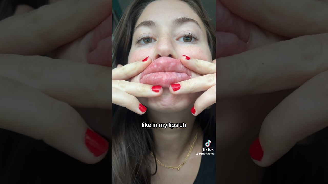 Big Lips…Big Question 