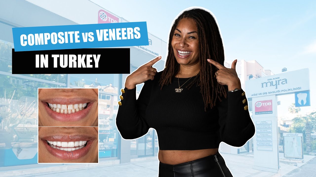Composite Veneers vs Laminate Veneers in Turkey 2021| Myra Dental Centre Turkey