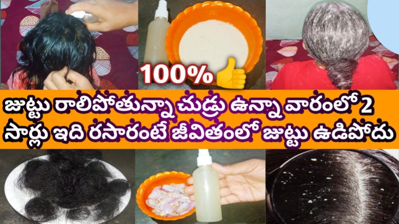 Hair Fall Solution At Home In Telugu|Hair Fall Tips In Telugu|Juttu Udakunda Undalante Em Cheyali|