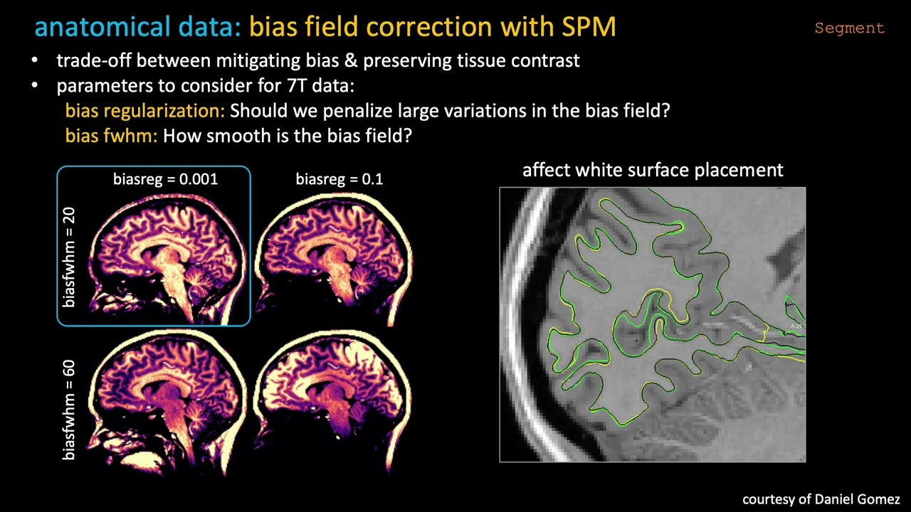 FreeSurfer processing pipeline for laminar fMRI: Anna I Błażejewska