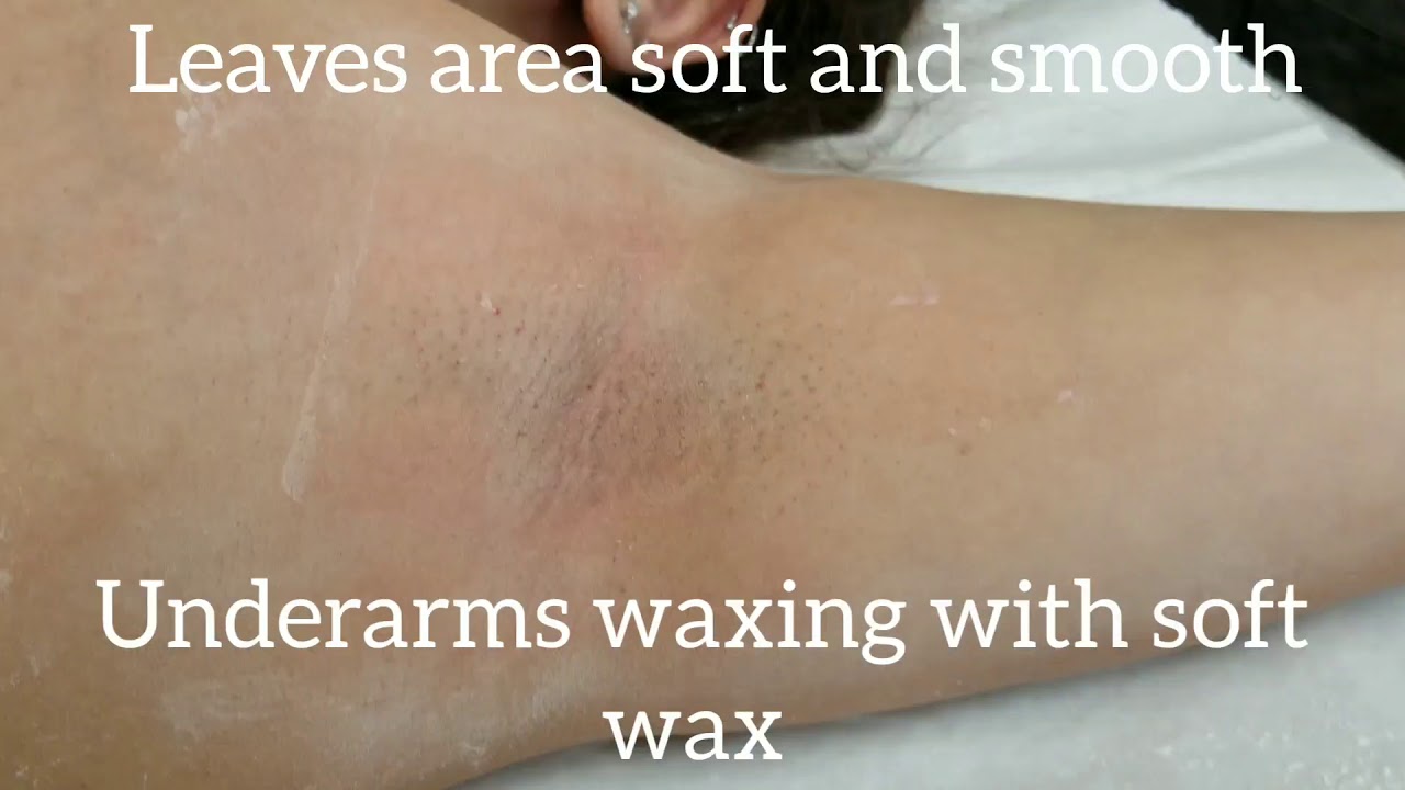 Underarms waxing with soft wax