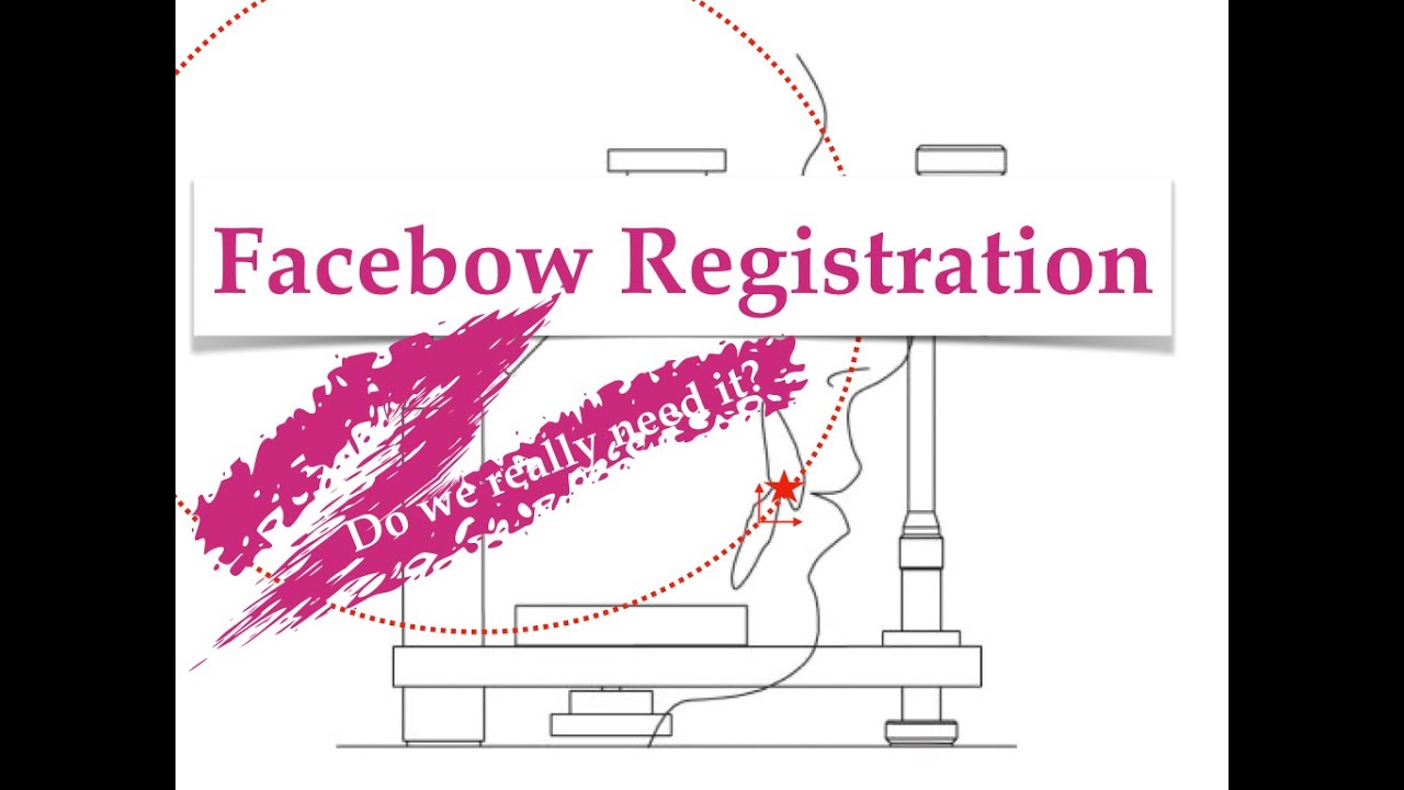 Для чего используется перенос лицевой дугой в артикулятор? Пояснение на примере Denar Mark II 320