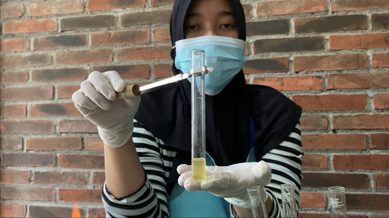 Pemeriksaan Protein Urine