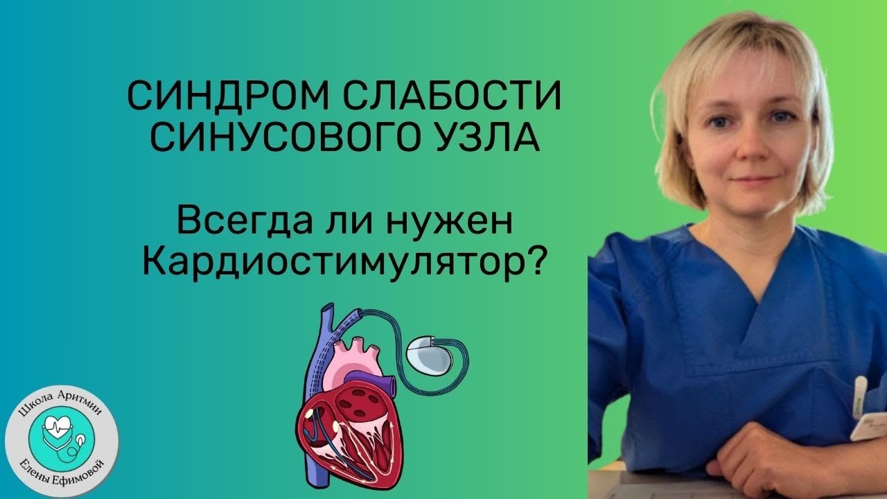 Синдром слабости синусового узла
