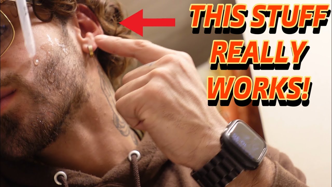 (Minoxidil tutorial) How to Grow a Beard From Scratch!
