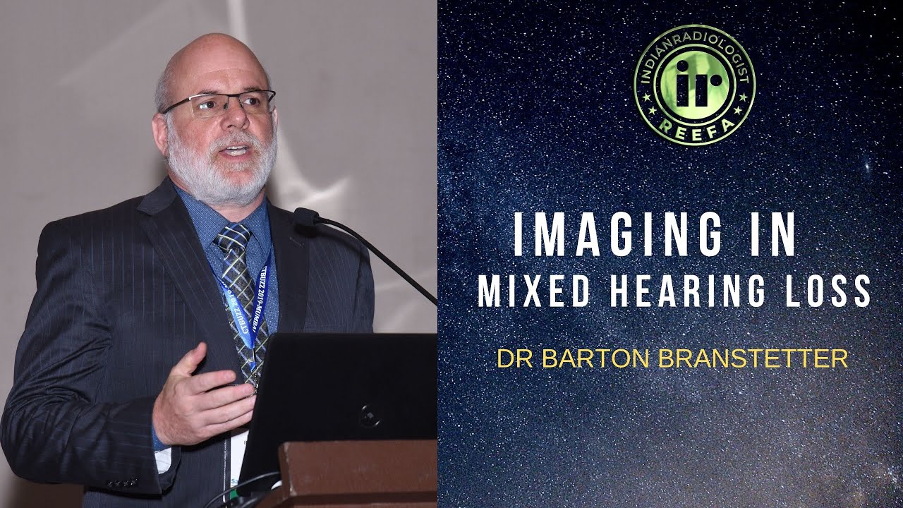 TMT: Mixed Hearing Loss by Dr Barton Branstetter