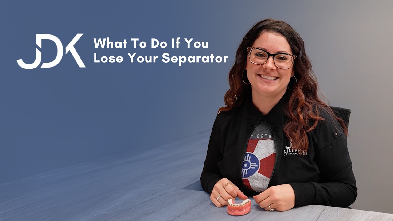 Dillehay Orthodontics | Lost Separator