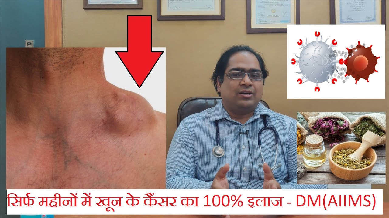 ब्लड कैंसर का पक्का इलाज - DM(AIIMS) - लिंफोमा स्टेज 4 से 1 का उपचार हिंदी में 2022