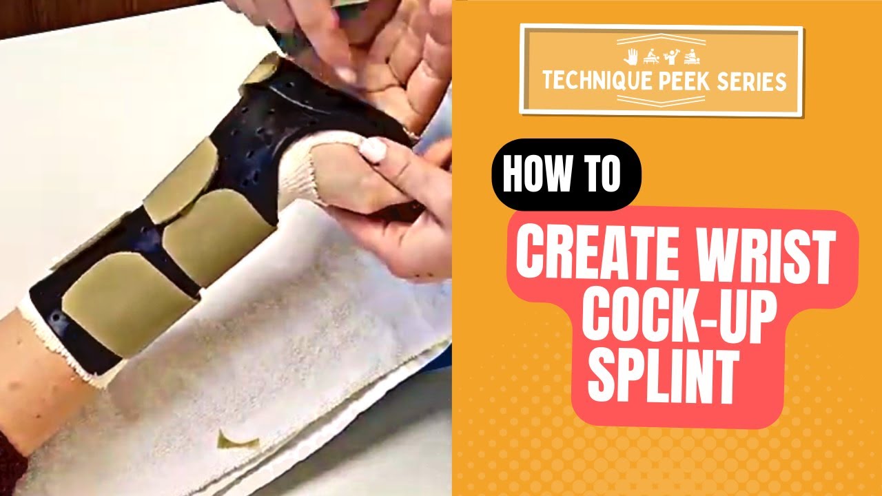 How to Create a Wrist Cock-up Splint  |  Technique Peek Series