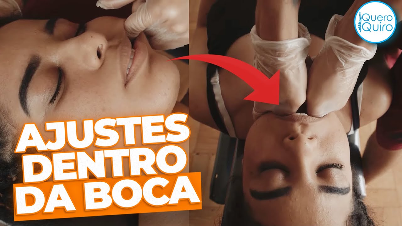 TRATAMENTO MAIS EFICAZ PRA BRUXISMO (VEJA A DIFERENÇA NO FINAL)