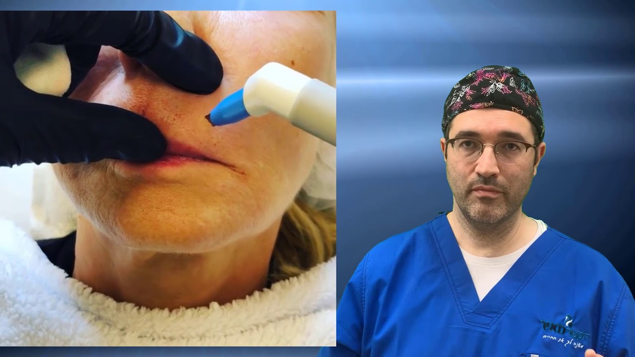 מיצוק וחיטוב קו לסת מיצוק צוואר מתיחת פנים ללא ניתוח