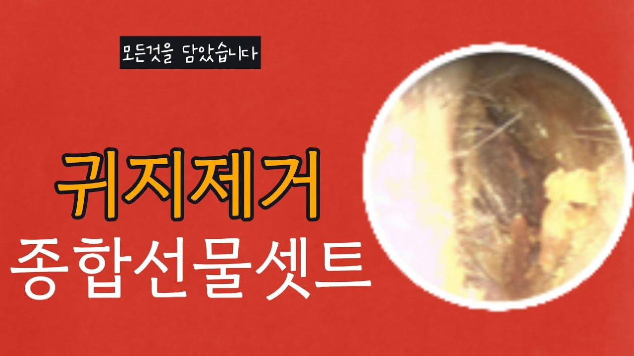 귀지제거종합선물셋트 - 이 영상 하나에 모든것을 담아보았습니다.