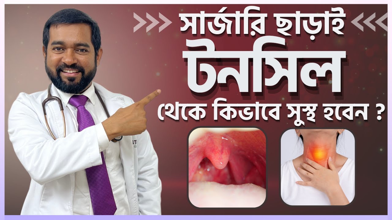 টনসিল হলেই কি সার্জারি করতে হয় ? টনসিল থেকে সুস্থ হবেন কিভাবে  ? | Dr Haque