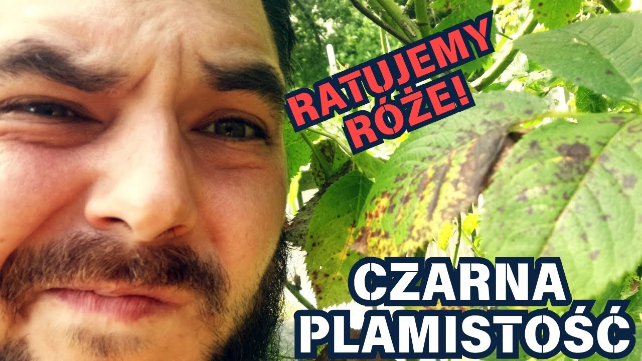 CZARNA PLAMISTOŚĆ - jak leczyć? 🌹 🖤