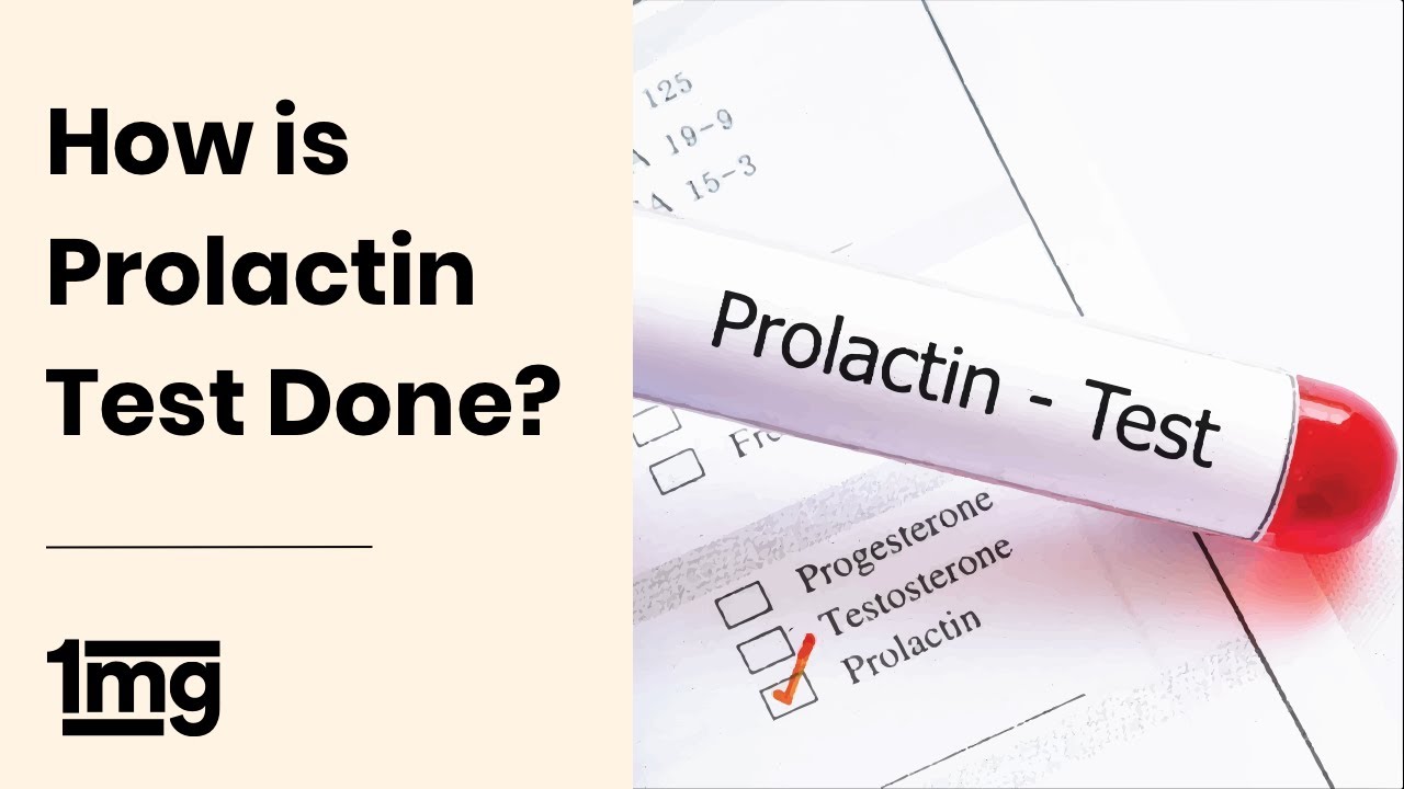 How is Prolactin Level Test Done | 1mg