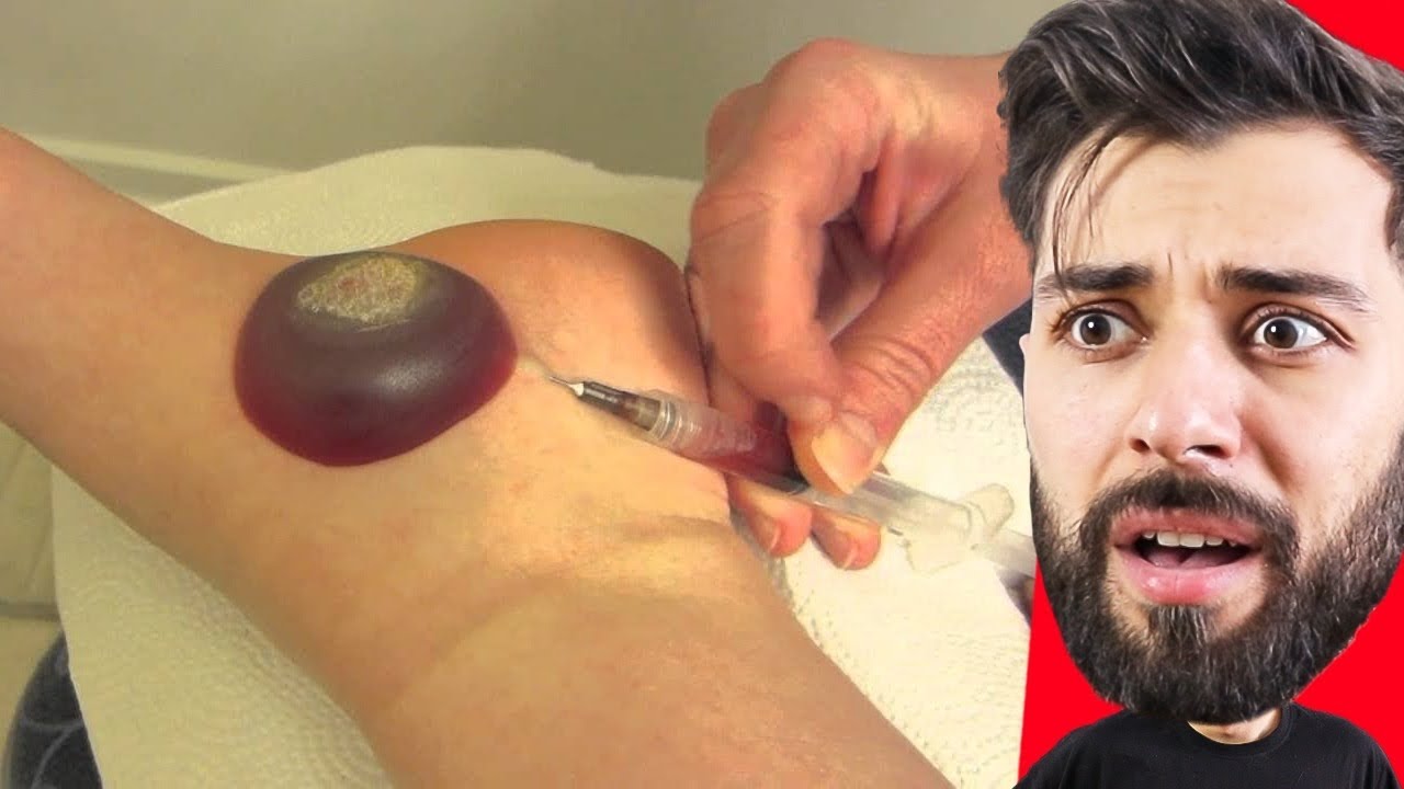 BU VİDEO SİZİ ÇOK SİNİRLENDİRECEK *Rahatsız Olacaksınız
