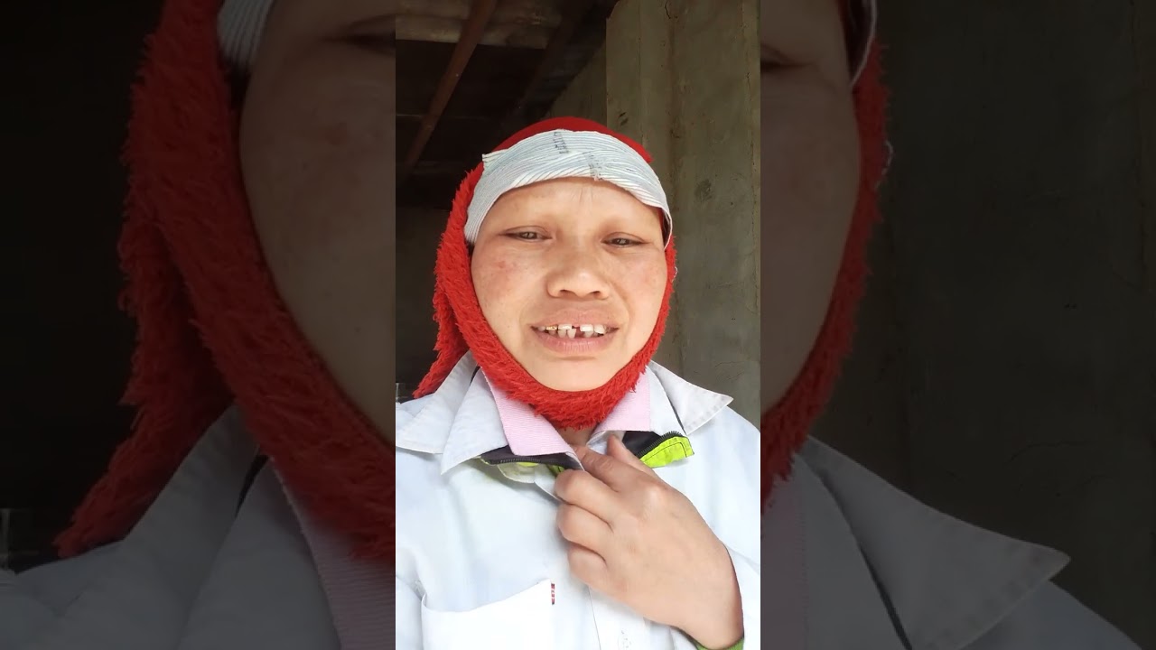 Pó đà mào ton nhi cấu