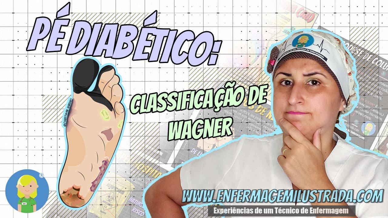 O PÉ DIABÉTICO e a Classificação de WAGNER