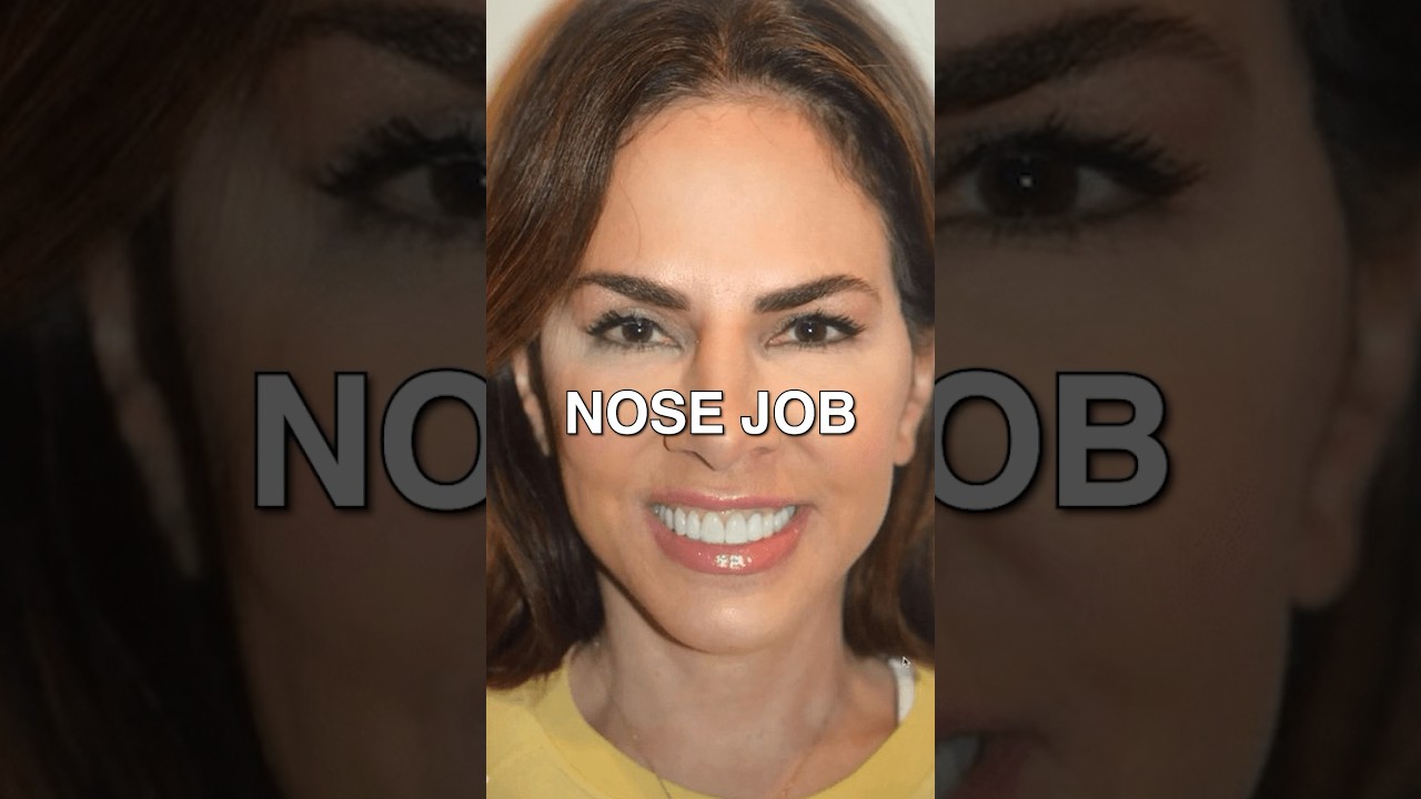 Is plastic surgery worth it? #Bravo #RHONJ #JenFessler #UnpolishedGems #housewives