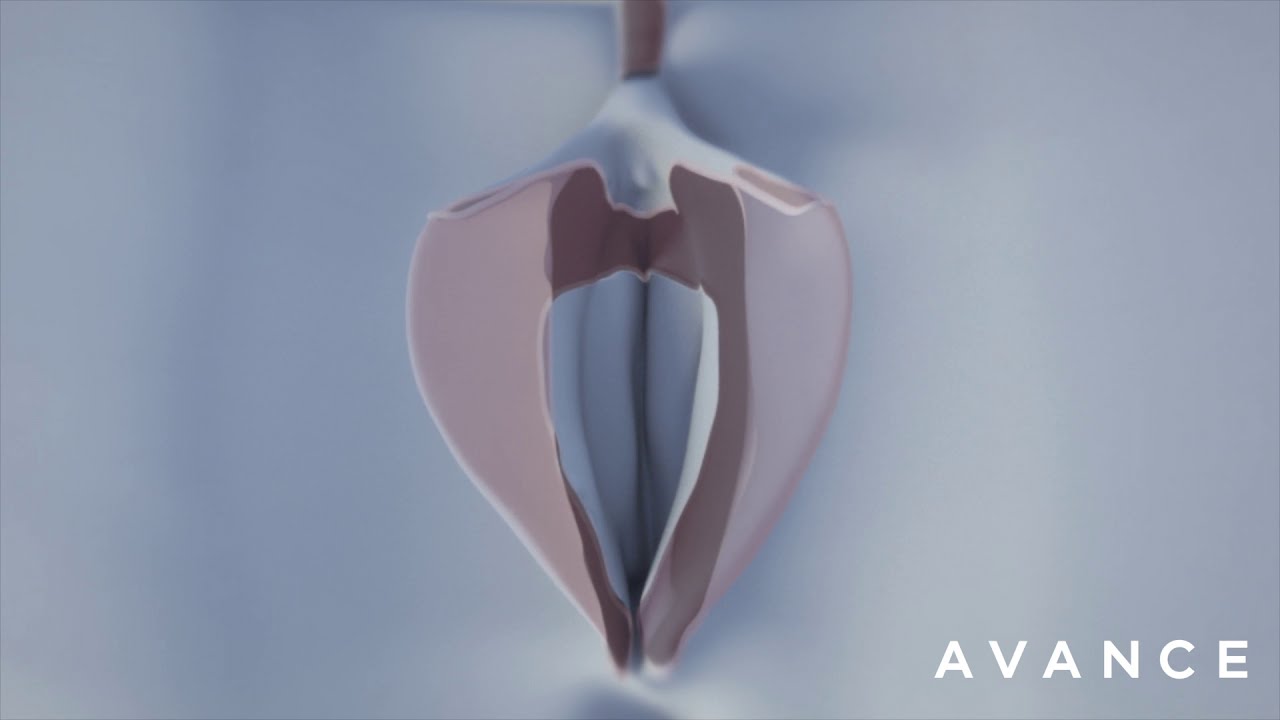 Vaginal Rejuvenation Dr. Erez Dayan Avance Plastic Surgery