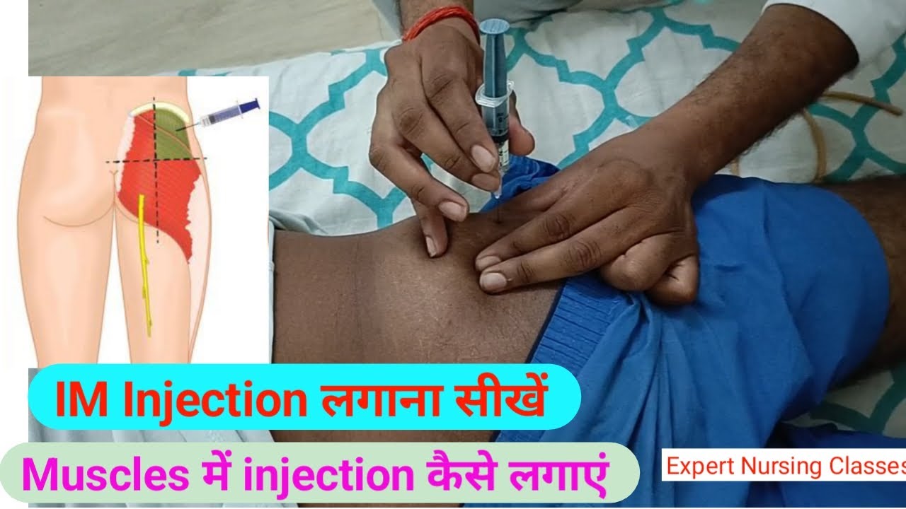 IM Injection लगाना सीखें || Gluteus muscle में IM Injection लगाना सीखें || IM Injection कैसे देते है