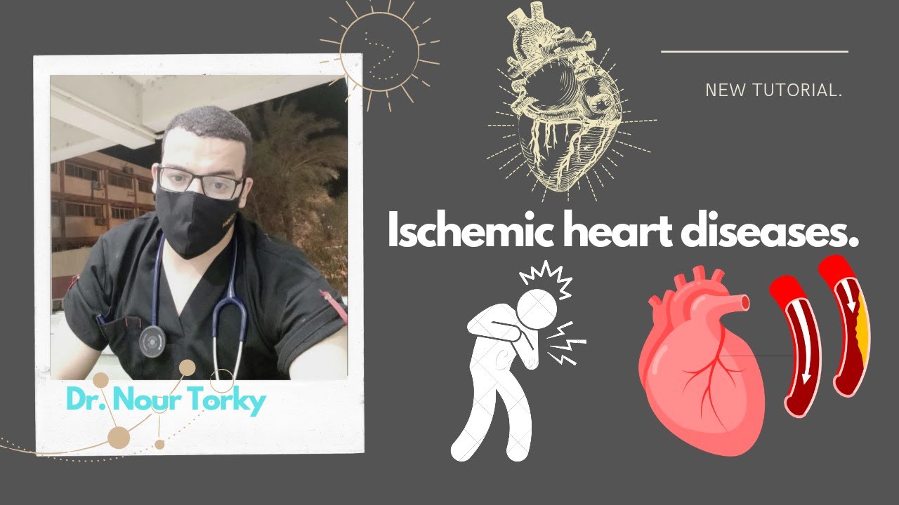 Ischemic heart diseases| كورس الباطنى العامة.