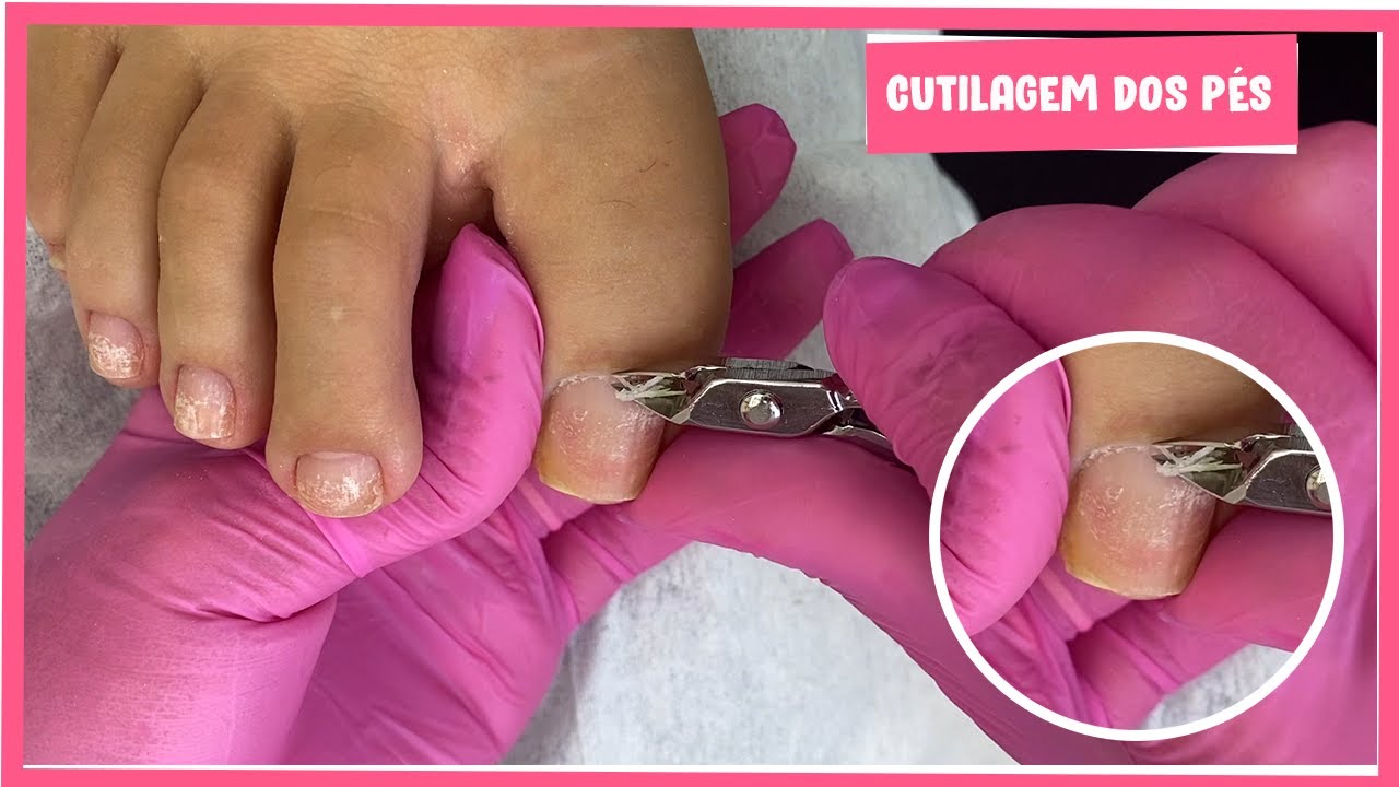 Cutilagem dos Pés, Mais uma aula de Cutilagem 🥰