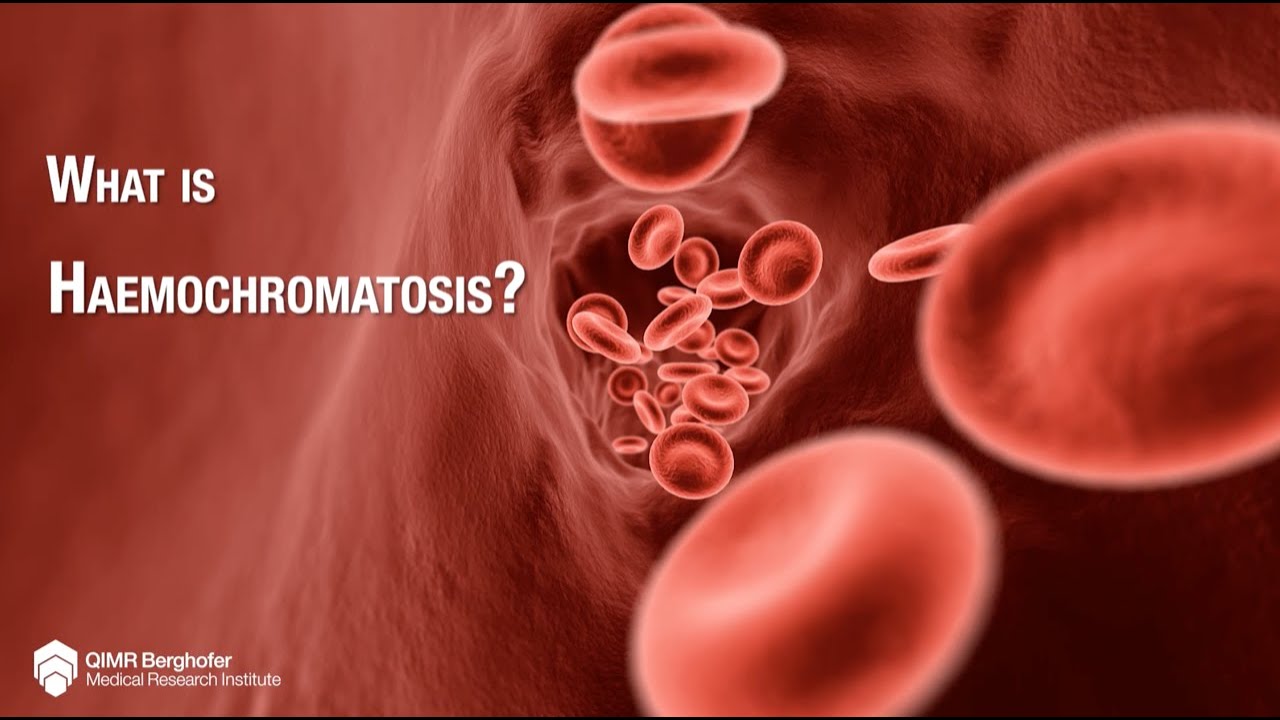 Haemochromatosis and the link between arthritis and liver disease