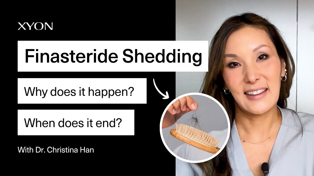 Finasteride Shedding: Why Does it Happen? How long Does It Last?