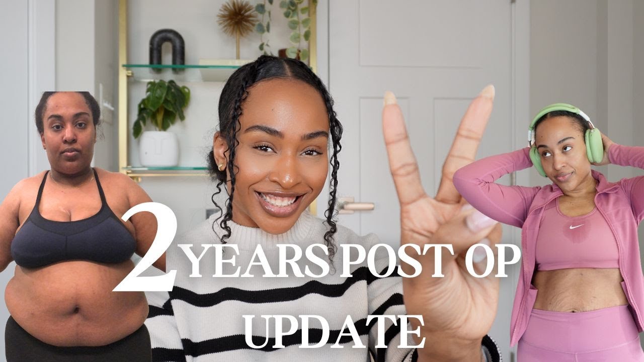 2 YEARS POST OP VSG UPDATE + WEIGH IN #bariatricsurgery