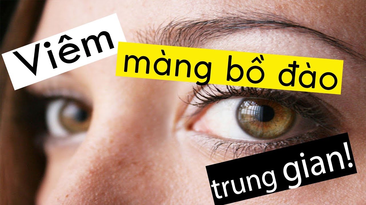 Vlog #19 - Tìm hiểu về viêm màng bồ đào trung gian - BS. Nguyễn Như Quân