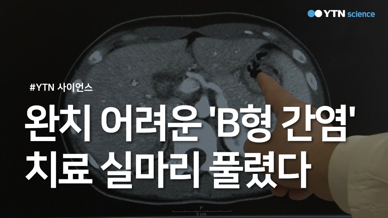 완치 어려운 'B형 간염'...치료 실마리 풀렸다 / YTN 사이언스