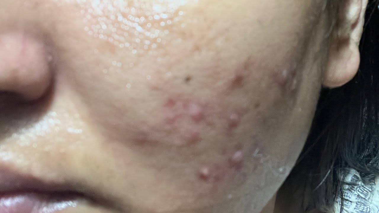 PM Skincare Routine 🌙 | Azelaic Acid Night + Niacinamide