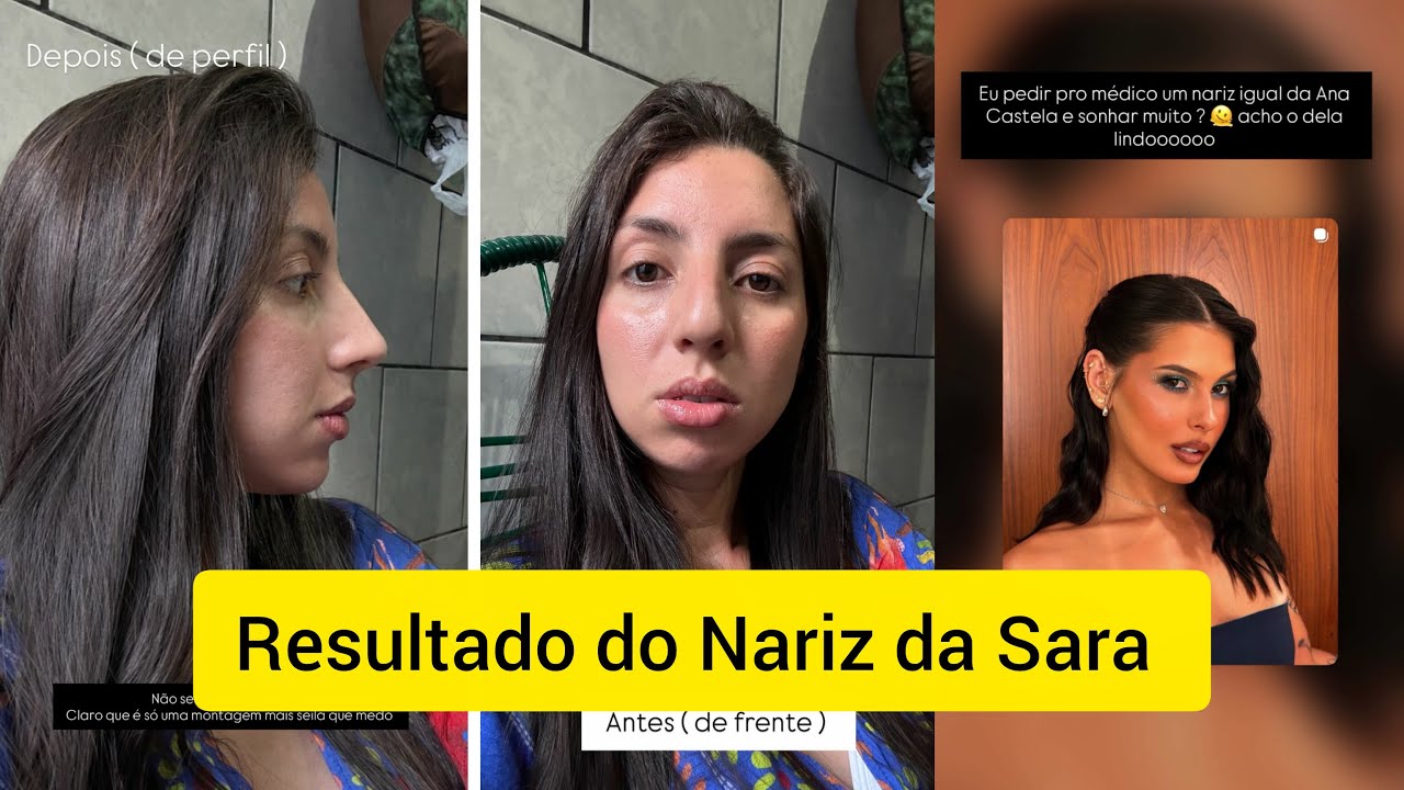 Sara Kellen quer o nariz da Ana Castela
