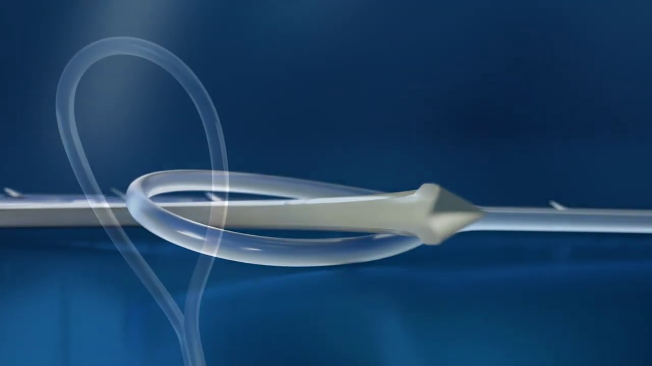 V-Loc&trade; Wound Closure Device Steps-for-Use Video
