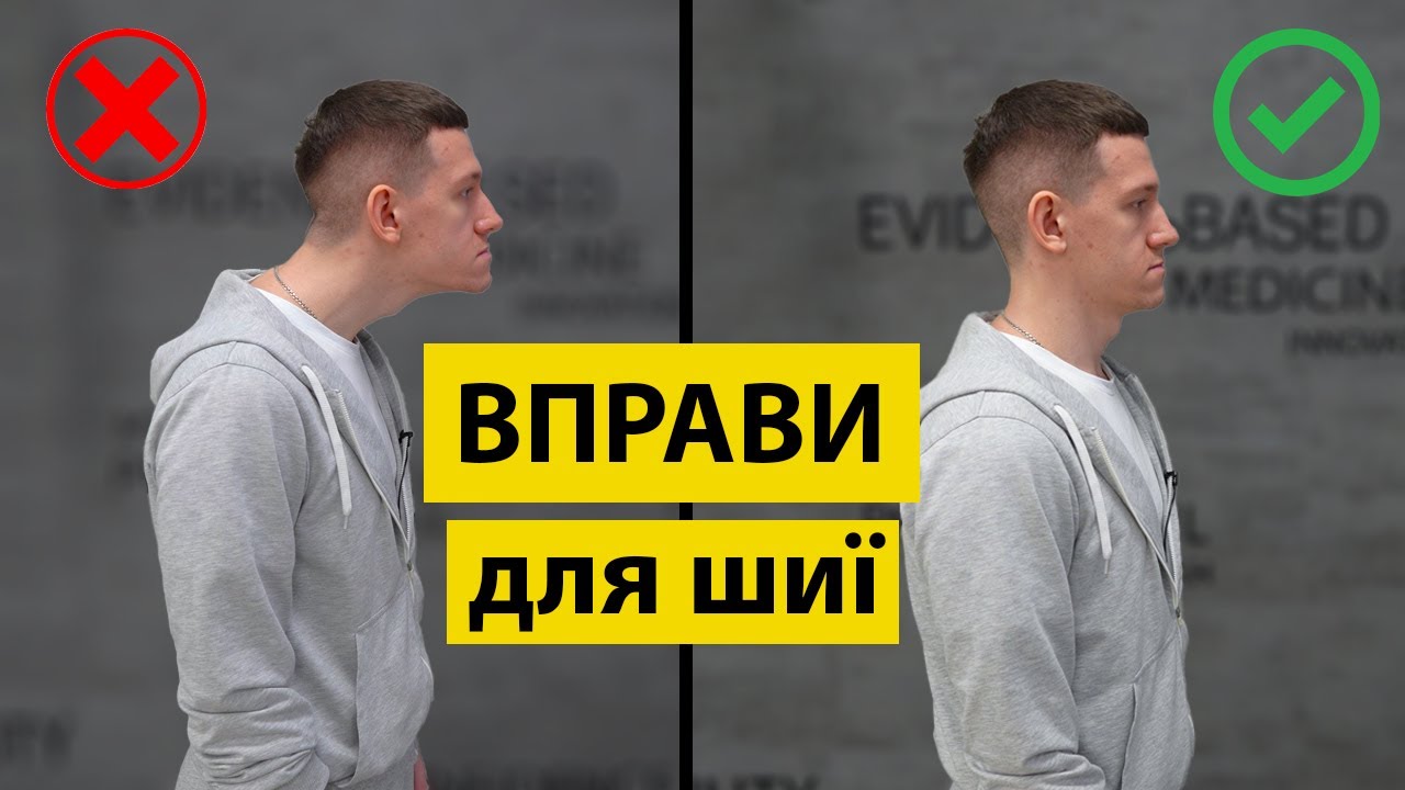 Як позбутися горба на шиї