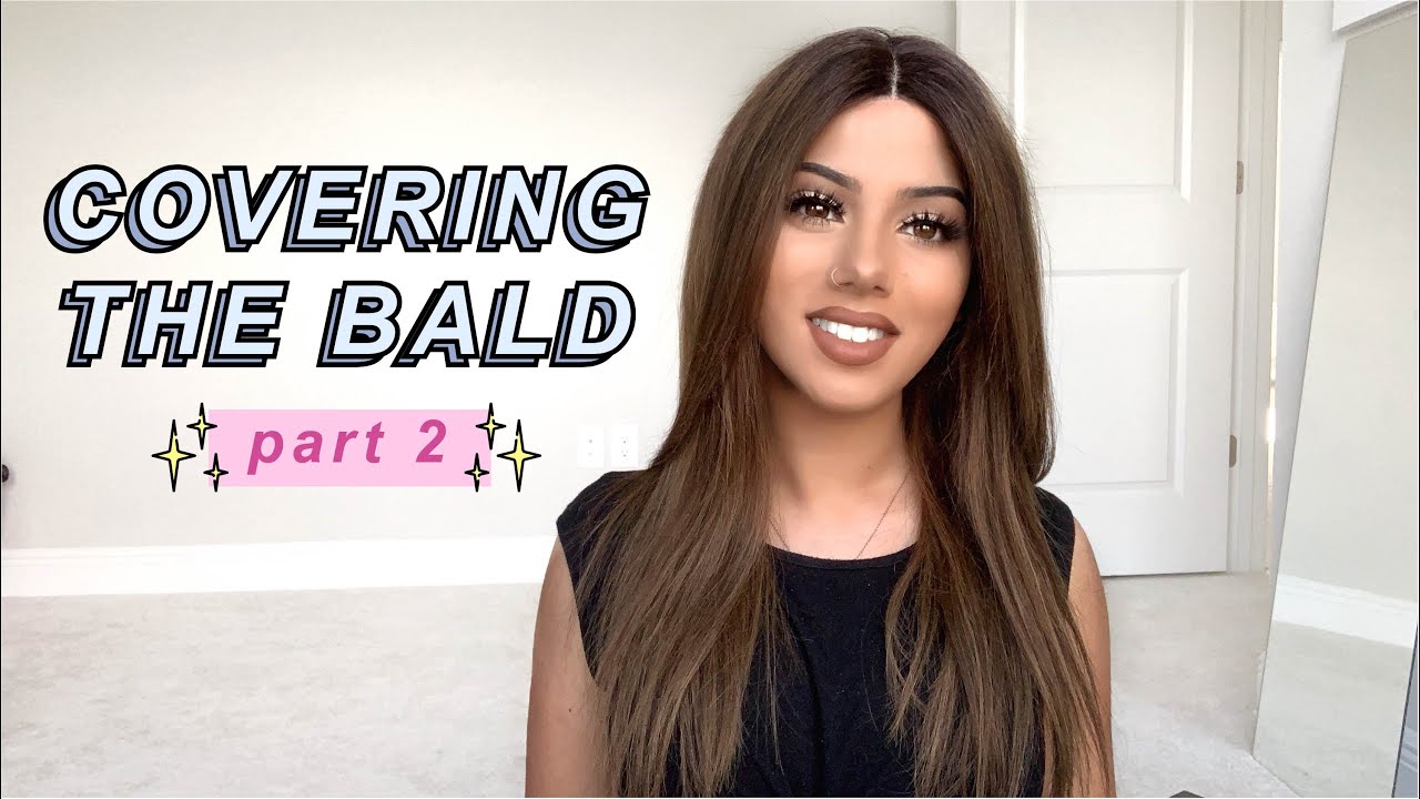 I GOT A 'FAKE SCALP' WIG?? | UniWigs Review | Zoe Cavey