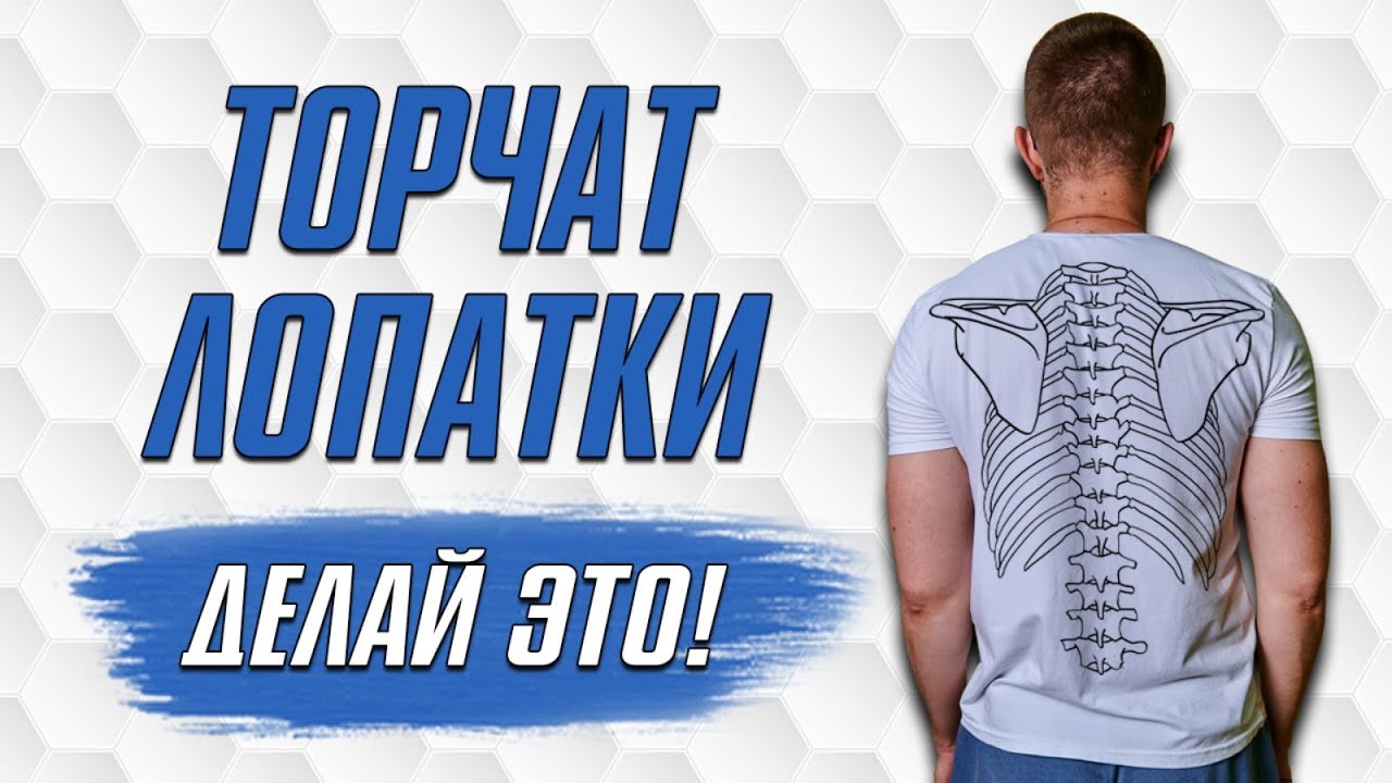 Что Делать Если у Меня ТОРЧАТ ЛОПАТКИ? Как Убрать Торчащие Лопатки?