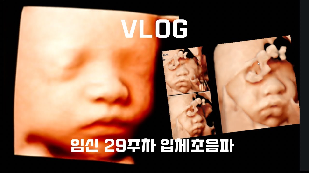 [임신 VLOG] 강동 고은빛 여성병원 입체초음파 임신 29주차 일상