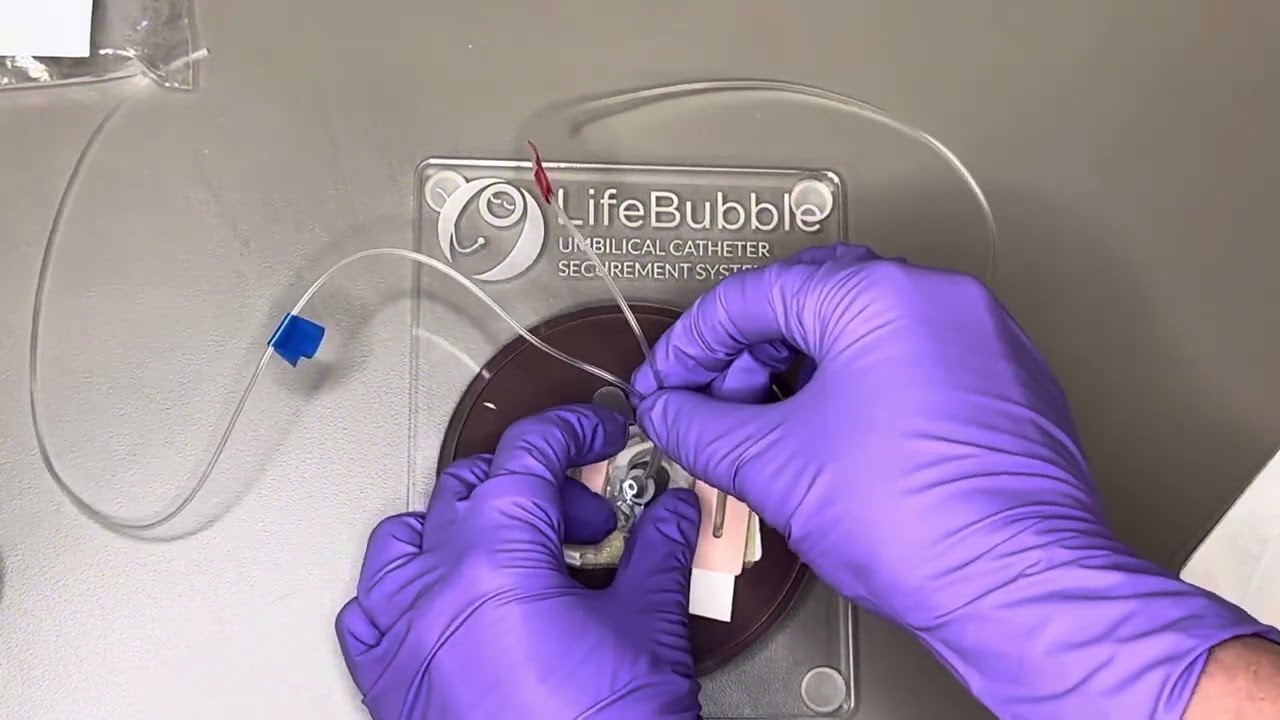 Umbilical Catheter Securement & Safety @UVA’s NICU 🫧