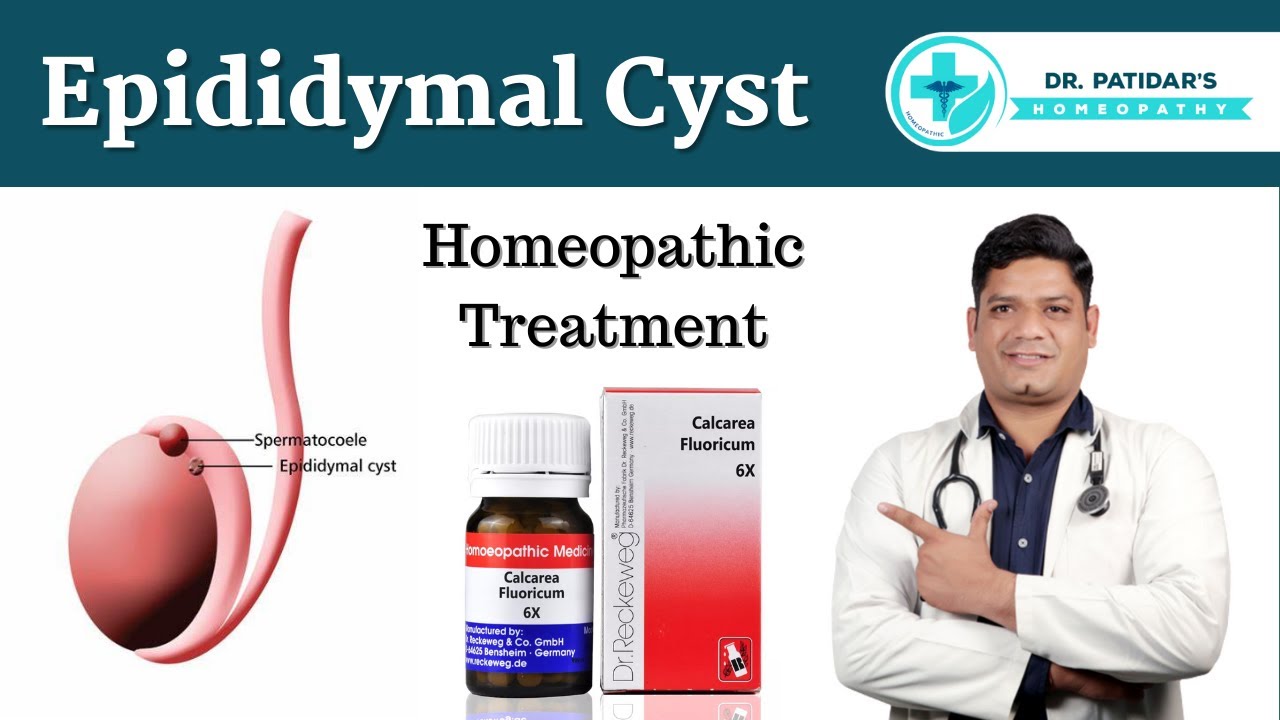 Epididymal Cyst Homeopathic Treatment & Medicines | Dr. Sunil Patidar