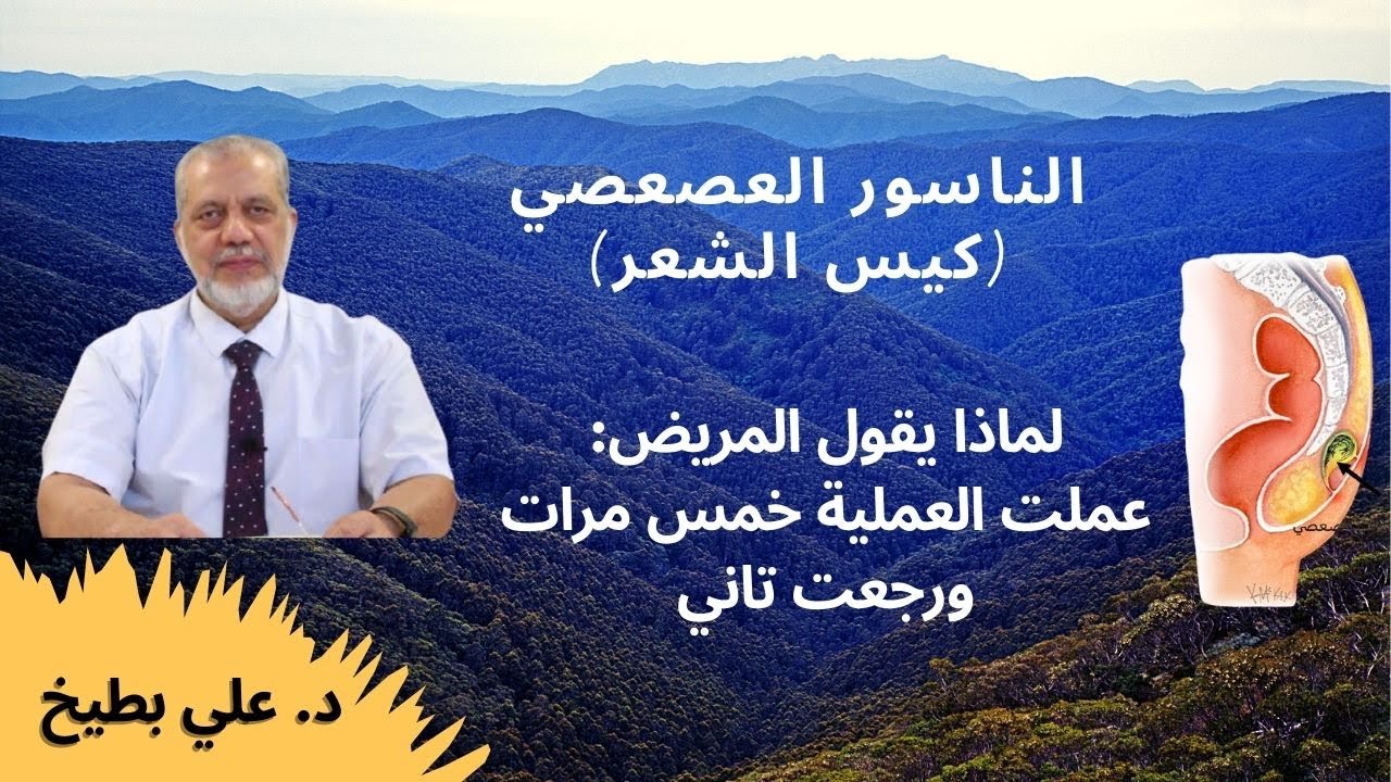 .. الناسور العصعصي (كيس الشعر) لماذا يقول المريض عملت العملية عدة مرات ورجعت تاني. ما هي أفضل عملية؟