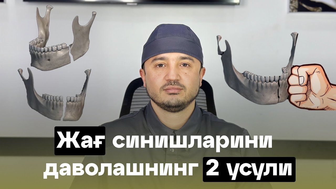 Жағ синишларини даволашнинг 2 усули. 2 способа лечения переломов челюсти.
