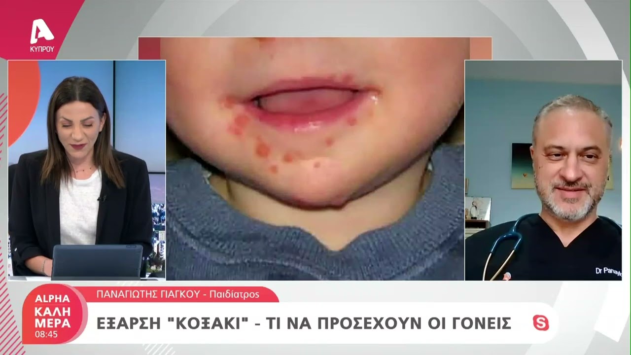 Έξαρση «κοξάκι» - Τι να προσέξουν οι γονείς | AlphaNews Live
