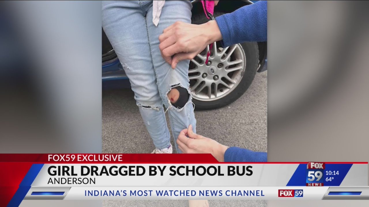 Anderson mom seeking answers after daughter dragged down street by school bus