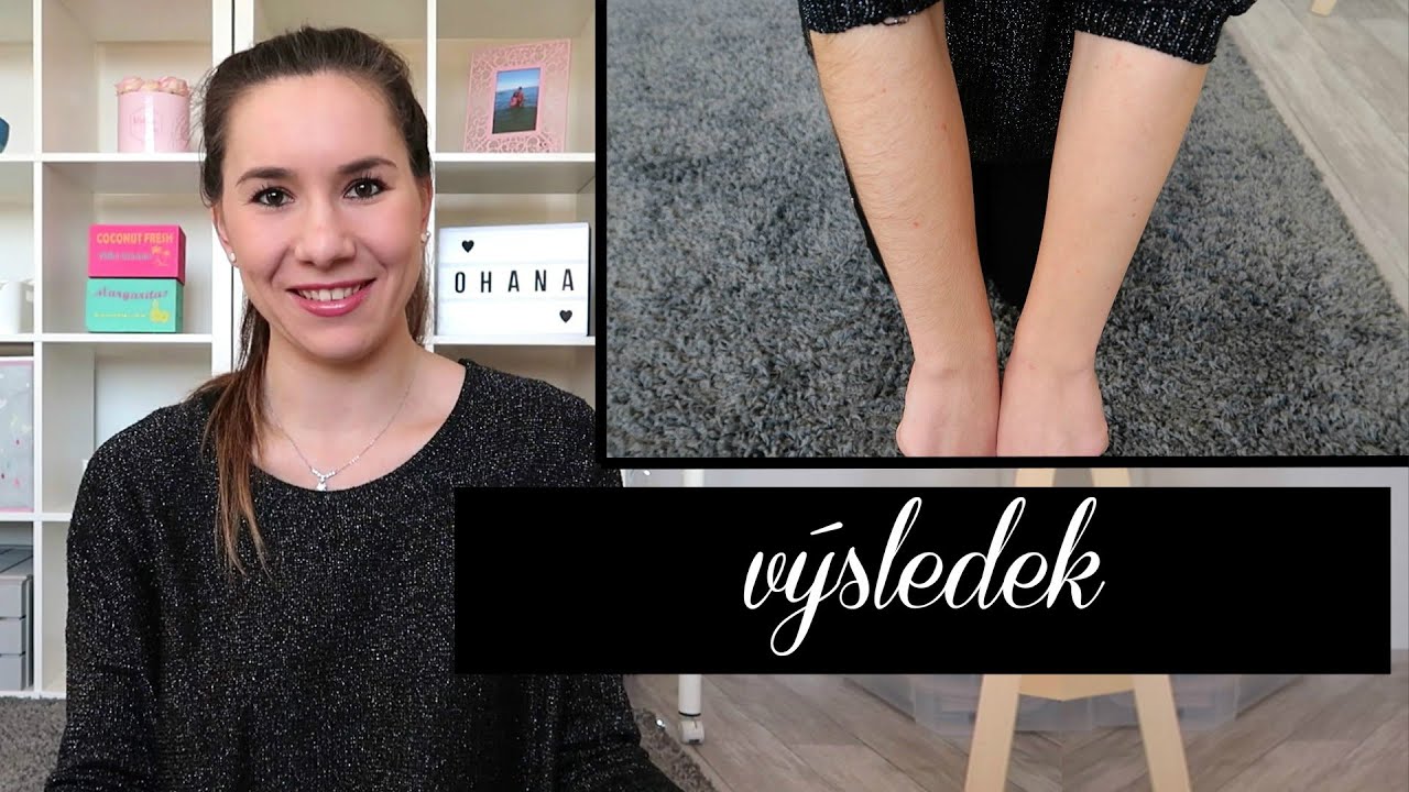 Moje TRVALÁ EPILACE PŘEDLOKTÍ - konečně výsledek!