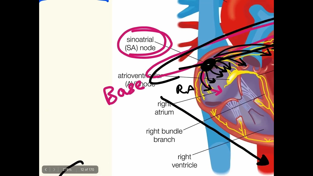 ECG 4