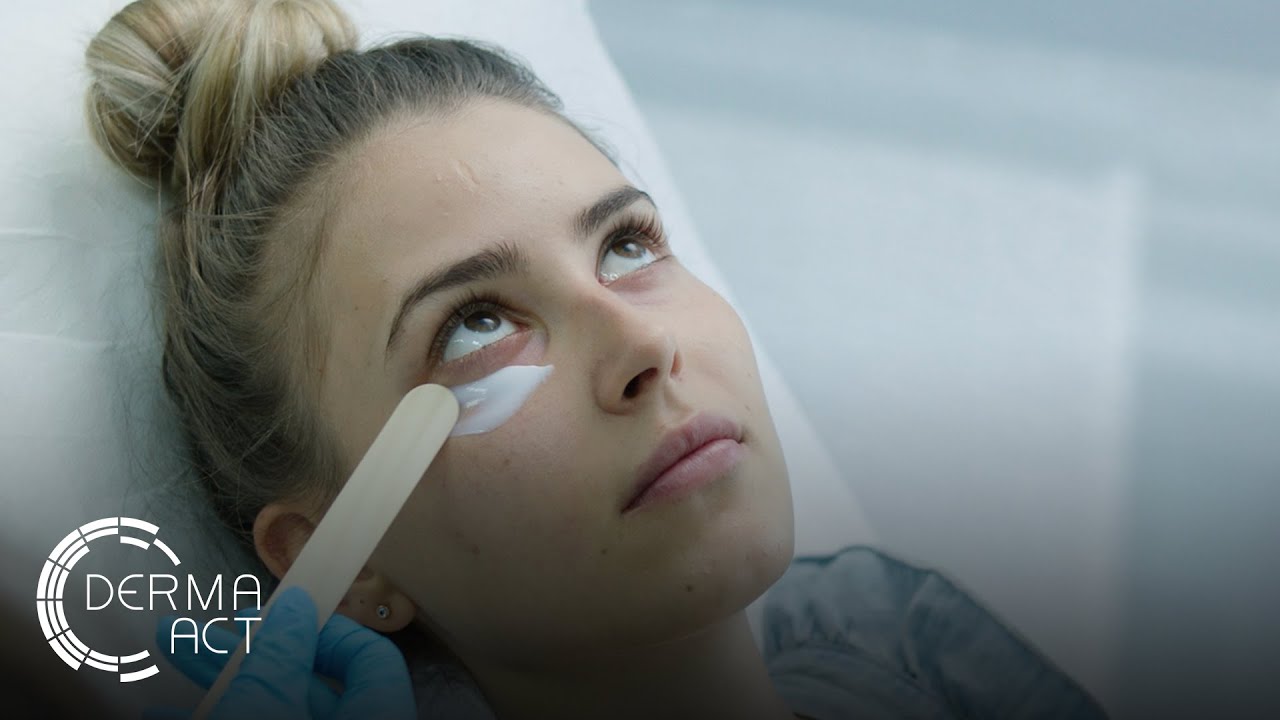 Мезотерапия на цяло лице в Derma-Act